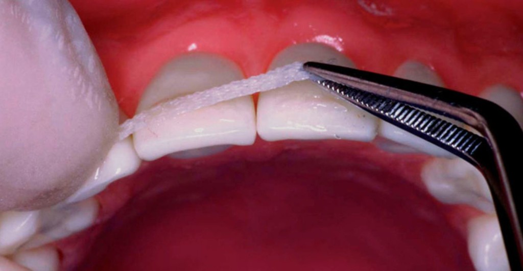lechenie-zubov-1